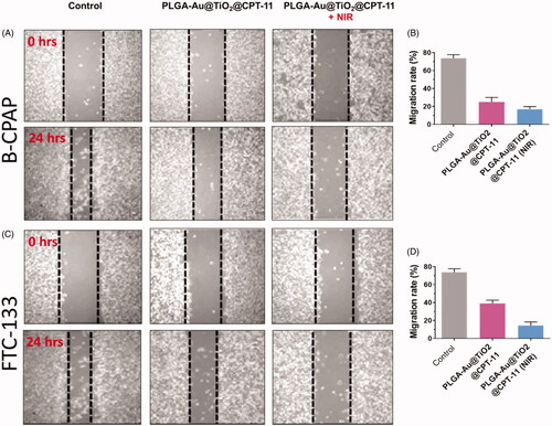 Figure 5. (A, C) The migration of B-CPAP and FTC-133 thyroid cancer cell lines was detected by a scratch assay. The B-CPAP and FTC-133 cells were treated with PLGA-Au-TiO2@CPT-11 and PLGA-Au-TiO2@CPT-11 + NIR (IC50 concentration) for 24 h. (B, D) Quantification analysis showed that PLGA-Au-TiO2@CPT-11 and PLGA-Au-TiO2@CPT-11 + NIR reduced B-CPAP and FTC-133 migration.