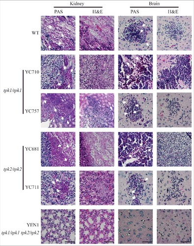 Figure 7. Both Tpk1 and Tpk2 are required for colonization and necrosis in kidneys and brains. Histopathological analyses of mouse kidney and brain organs obtained from C. tropicalis-infected mice at day 3. Organs were fixed in 10% formaldehyde solution, paraffin-embedded, and stained with PAS and H&E to observe C. tropicalis colonization and tissue necrosis, respectively. White arrowheads indicate fungal cells (hyphae or yeasts). Scale bar = 50 µm.