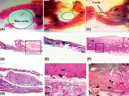 Figure 3. Histology of bone tissue by H&E staining in different groups at 28th day after surgery. Control (A, D, and G), Scaffold specimens (B, E, and H), and Scaffold with USSCs (C, F, and I) (scale bars: 100 mm).
