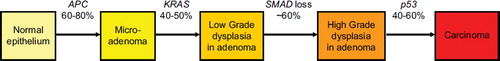 Figure 4. Colorectal adenoma-carcinoma progression sequence. The adenoma-carcinoma progression sequence shows the transitions from normal via the earliest stage of micro-adenoma formation (monocryptal adenoma or oligocryptal adenoma) to a small but well established adenoma with low grade dysplasia, a proportion of which may progress to form a larger adenoma with high grade dysplasia, from which a malignant clone may evolve and begin invasion into the bowel wall as a carcinoma. The most frequent genetic alterations are shown, including KRAS mutations, seen in 40–50% adenomas and carcinomas, that occur mostly during the early stages of adenoma growth and progression. APC is mutated in around 60–80% adenomas and carcinomas and occurs as a very early event, whereas p53 mutation is found in approximately 40–60% cancers appearing to occur as a late event around the time of transition to carcinoma. Many other genetic or epigenetic changes can occur during this sequence and loss of a large part of chromosome 18, containing the SMAD4 and SMAD2 genes, is among the more frequent of these.