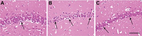 Figure 5 Representative photomicrographs of morphological changes in the hippocampal CA1 region.