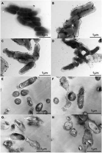 Figure 4 TEM images of T. pyogenes. (A and E) Bacteria untreated with luteolin. (B and F) Bacteria treated with 1/2 MIC luteolin for 12 h. (C and G) Bacteria treated with 1/2 MIC luteolin for 24 h. (D and H) Bacteria treated with 1/2 MIC luteolin for 36 h.