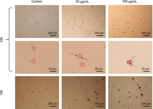 Figure 5 Prussian Blue staining of labeled A549 cells with 50 and 100 µg/mL at 24 and 72 h of incubation. The black arrows point to NPs inside the cells. The black arrows point to PEG-IONPs embedded in vesicles inside the cells. Images at 72 h of incubation with PEG-IONP showed a clear increase of the nanoparticles cellular uptake.