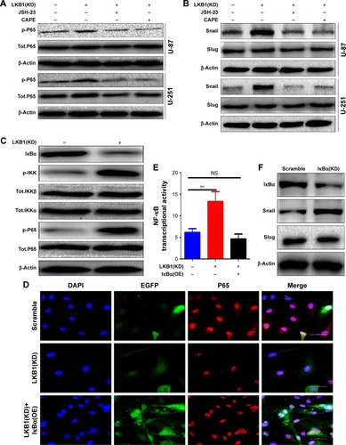 Figure 5 LKB1 regulates glioma cell proliferation, migration, and invasion via the NF-κB/Snail signaling pathway.Notes: (A and B) U-87 and U-251 cells transfected with LKB1 plasmid and co-cultured with NF-κB signaling inhibitors were reaped, and the lysates were immune-blotted for (A) p-P65 Tot.P65, (B) Snail, Slug, and β-actin. (C) LKB1 knockdown decreased the protein level of IκBα and increased the protein level of p-IKK and p-P65. Other proteins remain unchanged. (D) The p65 migrated to the nuclei of U-87 cells after LKB1 knockdown and its effects were abrogated by IκBα overexpression. (E) LKB1 knockdown induced NF-κB activation and IκBα overexpression abrogated its effects. (F) IκBα knockdown increased the protein level of Snail. Slug remains unchanged. Statistical significance was assessed using one-way ANOVA followed by Dunnett’s tests for multiple comparisons. Scale bars: 50 µm. **P<0.01.Abbreviations: LKB1, liver kinase B1; NS, no statistical significance.