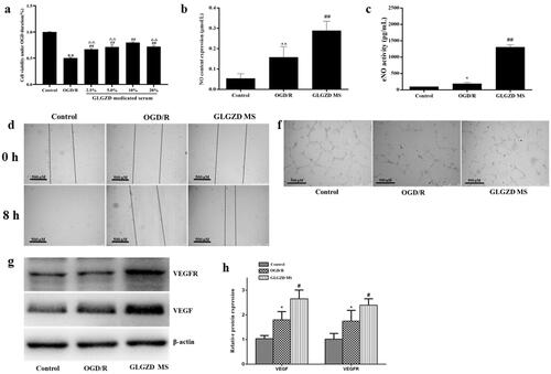 Figure 3. GLGZD enhances endothelial cell viability, migration and tube formation after hypoxia in vitro. (a) The results of CCK8 cell viability assay in HUVECs after OGD/R for each group. (b) The result of scratch assay in HUVECs after OGD/R for each group. (c) Representative photographs of tube formation in HUVECs after OGD/R for each group (scale bar = 500 μm). (d) The content of NO and eNOS in HUVECs after OGD/R for each group. (e, f) Western blotting results for relative protein expression of VEGF and VEGFR2 in HUVECs after OGD/R for each group. Data are presented as mean ± SD. *p < 0.05, **p < 0.01 vs. control, #p < 0.05, ##p < 0.01 vs. OGD/R, ΔΔp < 0.01 vs. 10% GLGZD MS.