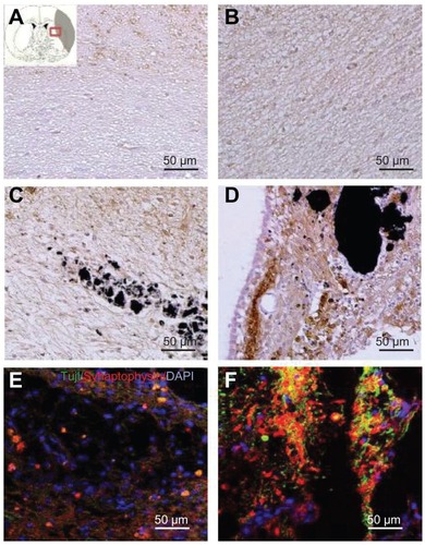 Figure 6 Images showing the neurogenesis and synapse formation based on the wettability of carbon nanotubes following middle cerebral artery occlusion injury. Microtubule-like associated protein 2 immunostaining was performed in (A) the experimental control group (without subventricular zone neural progenitor cell transplantation) and (B) the subventricular zone neural progenitor cells alone, (C) hydrophilic carbon nanotubes impregnated with subventricular zone neural progenitor cell, and (D) hydrophobic carbon nanotubes impregnated with subventricular zone neural progenitor cell transplantation groups at 5 weeks after middle cerebral artery occlusion injury. Synaptophysin (a synapse marker; red) and TUJ1 (a neuronal marker; green) – which reportedly correspond to synapses – immunostaining was carried out at 5 weeks after transplantation with (E) hydrophilic and (F) hydrophobic carbon nanotubes impregnated with subventricular zone neural progenitor cells.Note: Scale bars =50 μm.Abbreviation: DAPI, 4′,6-diamidino-2-phenylindole.