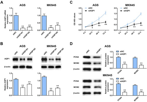 Figure 2. Interference of AQP-1 inhibited gastric cancer proliferation. (A) Transfection efficiency of siAQP1 #1 or #2 in AGS and MKN45 cells detected by qRT-PCR. ** represents siAQP1 #1 or #2 vs. siNC, P < .01. (B) Transfection efficiency of siAQP1 #1 or #2 in AGS and MKN45 cells detected by western blot. ** represents siAQP1 #1 or #2 vs. siNC, P < .01. (C) The effect of AQP-1 on cell proliferation of AGS and MKN45 cells detected by CCK8. *, ** represents siAQP1 vs. siNC, P < .05, P < .01. (D) The effect of AQP-1 on protein expression of PCNA and MCM2 in AGS and MKN45 cells detected by western blot. ** represents siAQP1 vs. siNC, P <  .01.