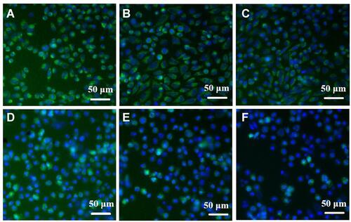 Figure 7 High content imaging of Au@MPA-PEG-FA-PTX effect on MMP in HeLa cells. (A) Control, (B–F) Au@MPA-PEG-FA-PTX (1, 3, 5, 10, 15 μg/mL).