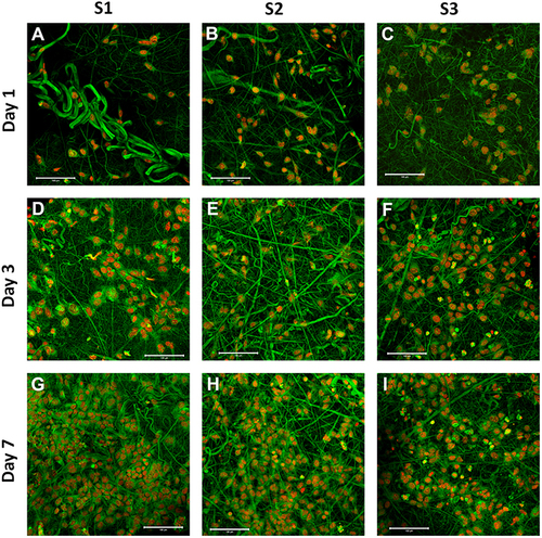 Figure 3 Visualization of Saos-2 cells adhesion and distribution on scaffolds S1 (ALN+, HA-, P31R1-), S2 (ALN+, HA+, P31R1+) and S3 (ALN-, HA+, P31R1+) using confocal microscopy. Cell nuclei were stained by propidium iodide (red color) and cell internal membranes by DiOC6(3) (green color), scale bar 100 µm. Sample S1, day 1 (A), S2, day 1 (B), S3, day 1 (C), S1, day 3 (D), S2, day 3 (E), S3, day 3 (F), S1, day 7 (G), S2, day 7 (H), S3, day 7 (I).