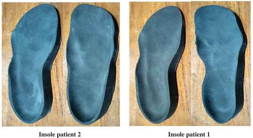 Figure 8. Insole of shoes manufactured for two patients.