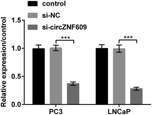 Figure 2. Circular RNA circZNF609 (circZNF609) was silenced in PC3 and LNCaP cells. The level of circZNF609 was declined in PC3 and LNCaP cells while circZNF609 was silenced. (***p < .001).