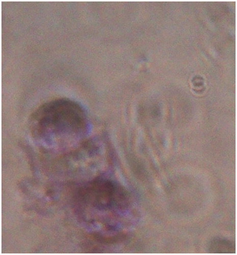 Figure 3. A photograph showing PCM in chondron as a bluish surrounding. Stained with toluidine blue, 40×.