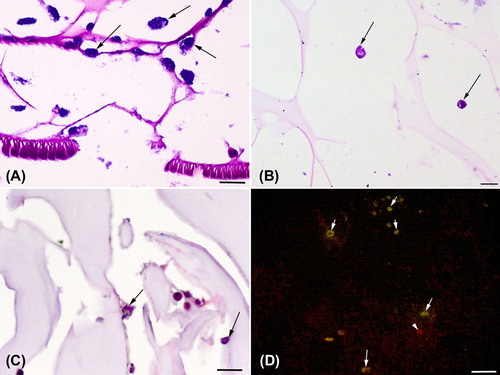 Figure 4. Histology of the chondrocyte seeded scaffolds. A. Chondrocytes are attached to scaffolds well and exhibited metachromatic staining. B. At the 14th day of the culture, chondrocytes with metachromatic staining can be seen C. Chondrocyte attachments onto the wall pore (arrows), D. Collagen type II immunoreactive chondrocytes (arrows) and non-immunoreactive chondrocytes (arrow head). Toluidine blue staing (A and B), hematoxylin&Eosin (C) and Collagen type immunoflourecence with FITC maker and propidium iodide nuclear staining. Bar = 80 μm in A, B, and C and = 160 μm.