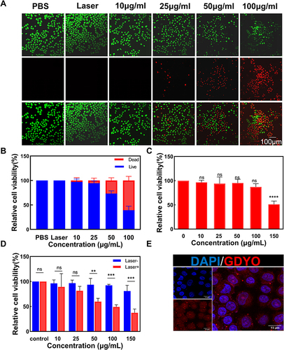 Figure 2 In vitro anticancer efficacy. (A) Antitumor effects of GDYO-PDT in SCC9 cells stained with PI (red, dead cells) and calcein AM (green, live cells), respectively. Fluorescent images were obtained by fluorescence microscopy. Scale bar = 100 nm. (B) Relative fluorescence quantitative analysis of live/dead fluorescence microscopy. (C) Cell viability of GDYO at different concentrations in the NOK normal cell line. (D) Cell viability of SCC9 cells incubated with GDYO at different concentrations under irradiation. (E) Confocal microscopic images of SCC9 cells after exposure to GDYO for 6 h. Scale bar = 15 μm. **P <0.01, ***P <0.001, ****P <0.0001.