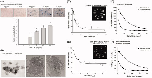 Figure 5. In vitro validation of PEG–SPIO nanoparticles for MRI-based P-MSCs tracking. P-MSCs were incubated with the indicated concentration of PEG-SPIO nanoparticles for 15 min and then subjected to (A) Prussian blue staining for SPIO-positive cells and quantification of magnetic labelling efficiency using Image J software (*P ≦ .05 and **P ≦ .01), and (B) TEM to measure the size of PEG-SPIO nanoparticles (left, magnification = 150,000×) and determine cellular localization of nanoparticles (middle and right, magnification = 10,000×). T2 MR phantom images and quantified T2 relaxation time of (C) different amounts of PEG–SPIO nanoparticles alone and (E) its labelled P-MSCs under an 8.5-ms echo time. (D,F) Graph illustrates signal intensity (in arbitrary units) difference between 0 and 45 μg/mL PEG–SPIO phantoms alone and labelled P-MSCs.