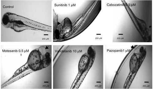 Figure S1 Gross morphological changes in the zebrafish larvae following VEGFR inhibitors at 96 hours.
