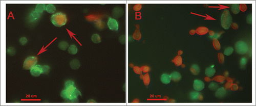 Figure 7. Phagocytosis of Paracoccidioides spp by hemocytic cells after 3 h of infection with 5×106 cells/larva from P. brasiliensis (A) and P. lutzii (B). The arrow indicates the phagocytosis.