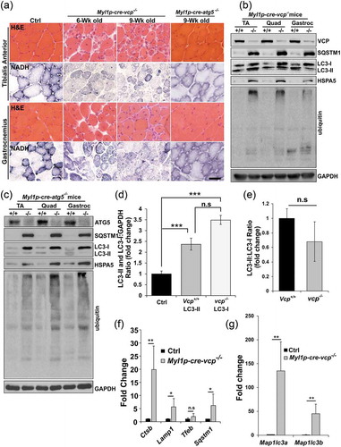 Figure 2. Muscle-specific inactivation of VCP leads to a myopathy. (a) Hematoxylin and eosin (H & E) or NADH staining of tibialis anterior and gastrocnemius from 6-week-old control, 6- and 9-week-old Myl1p-cre-vcp-/- or 9-week-old Myl1p-cre-atg5-/- mice. (b) Immunoblot of lysates from TA, quadriceps, or gastrocnemius of 6-week-old control (+/+) or Myl1p-cre-vcp-/- (-/-) mice using antibodies to VCP, SQSTM1, LC3, HSPA5, ubiquitin or GAPDH. (c) Immunoblot of lysates from TA, quadriceps or gastrocnemius muscle of 9-week-old control or Myl1p-cre-atg5-/- mice using antibodies to ATG5, SQSTM1, LC3, HSPA5, ubiquitin or GAPDH. (d) Densitometric analysis of LC3-I and LC3-II levels in control and Myl1p-cre-vcp-/- mouse muscle. N = 3 mice per group. Quantification was performed using western blots of TA’s, quadriceps, and gastrocnemius from each mouse. Comparison between groups was performed using a paired Student t-test. (e) Densitometric ratios of LC3-II:LC3-I levels in control and Myl1p-cre-vcp-/- mouse muscle. N = 3 mice per group. Quantification was performed using western blots of TA’s, quadriceps, and gastrocnemius from each mouse. Comparison between groups was performed using a paired Student t-test. (f) Graph of fold expression change of mRNA of lysosomal proteins from the TA muscle from 9-week-old control or Myl1p-cre-vcp-/- mice. (g) Graph of fold expression change of mRNA of Map1lc3a/b from the TA muscle from 9-week-old control or Myl1p-cre-vcp-/- mice. *p < 0.05; **p < 0.01; ***p < 0.001; n.s., not significant. Scale: 100 μm.