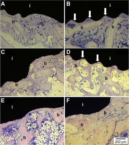 Figure 8 Histological cross sections after 2, 4 and 6 weeks of the control group (A: 2 weeks, C: 4 weeks, E: 6 weeks) and the coated group (B: 2 weeks, D: 4 weeks, F: 6 weeks). Both groups showed a good periimplantosteogenesis, ie, formation of cancellous periimplant bone, intratrabecular loose connective tissue, vessels and fatty bone marrow. Moreover the coated group showed bone formation directly on the implant surface (white arrows).Abbreviations: i, implant; b, bone.