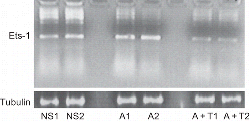 FIGURE 1. Ang II enhances renal cortical tissue expression of Ets-1. RNAs were extracted from renal cortical tissues of normal saline (n = 2), Ang II (n = 2), and Ang II + telmisartan (n = 2) -receiving mice and probed for Ets-1 and tubulin by RT-PCR.