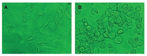 Figure 12 Human umbilical vein endothelial cells (HUVECs) (A) and glioma cells (B) after 24 hours of incubation with bare quantum dots.Note: The phase contrast images clearly show that HUVECs have started to undergo cell death, whereas the glioma cells are dead and rounded.