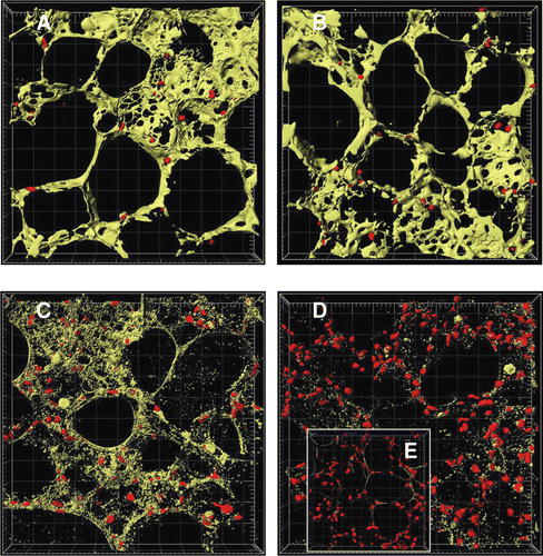 Figure 3.  Image analysis of time-dependent cell death in murine precision-cut lung slices. Tissue slices were stained with 4 µM calcein AM and 4 µM EthD-1 after 4 h (A), 24 h (B), 48 h (C), and 72 h (D) of cultivation and after cell lysis (E). The images were examined by two-colour immunofluorescence confocal microscopy (40× water immersion objective, excitation wavelengths 488 nm and 543 nm, emission filters BP 505–550 nm and LP 560 nm, thickness 20 µm, grid spacing = 20 µm) and analysed with IMARIS 4.5.2. Red colour shows cell nuclei (Ø 5 µm) of dead cells and green colour the cytoplasm of viable cells. Picture was reproduced with permission from CitationHenjakovic et al. 2008a.