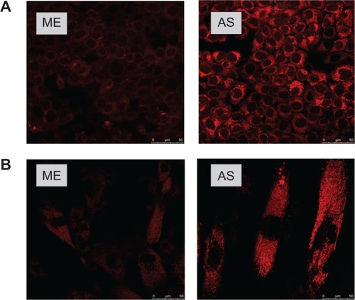 Figure 8 Laser scanning confocal microscopy images showing (A) human immortalized epidermal cells (HaCaT) and (B) human embryonic skin fibroblasts (CCC-ESF-1) incubated with rhodamine 110-labeled microemulsion (ME) and aqueous suspension (AS) for 8 hours.