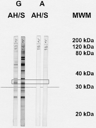 FIGURE 1  Recognition of toxoplasmal antigens by specific antibodies of the IgG (G) and IgA (A) type in samples of aqueous humor (AH) and serum (S) that were derived from a patient with acute ocular toxoplasmosis. The boxed region corresponds to an antigen size of 30 kDa, which is the most relevant one in the context of infection with Toxoplasma. Bands that are detected by immunoblotting in the aqueous humor but not in the serum correspond to antibodies that are produced locally but not systemically. MWM, molecullar weight marker (in kDa).