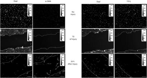 Figure 1. Acquisition of migratory capacity of AECs after mechanical injury. Confluent primary AECs monolayers plated into labteck were mechanically injured by scratch. At T0 and 16 hours later, cells were fixed and immunostaining of α-SMA or TTF1 were performed. Images were presented in 8-bit grey panel. A calibration bar has been added in each picture. A representative picture of at least n = 3 independent AEC cultures for each condition has been presented. Original magnification: × 200, Scale Bar rep-resent 50 µm.