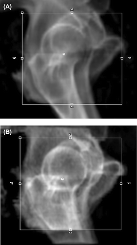 Figure 4. DRR image generated from A) actual CT image and B) pseudo-CT image with HU-values inside the bones converted from the MRI. The field size is equal in the both images. Lateral images were chosen to demonstrate clear visibility of bone edges through whole transversal section of the pelvic bones.