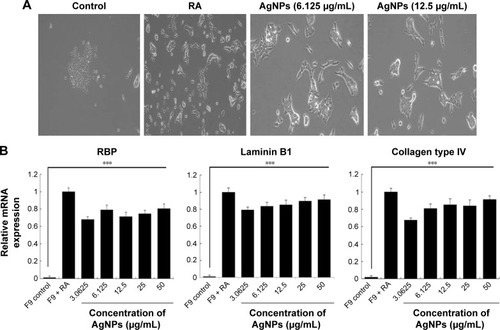 Figure 7 Effect of AgNPs on expression of differentiation markers.Notes: (A) F9 cells were treated with or without RA (1 μM) for 72 h or AgNPs (6.125 or 12.5 μg/mL) for 24 h, and differentiation was observed by phase contrast microscopy. (B) Real-time quantitative PCR was performed to analyze the expression of various neuronal differentiation markers. The results are expressed as the mean ± standard deviation of three separate experiments. The treated groups showed statistically significant differences from the control group determined using Student’s t-test (***P<0.001).Abbreviations: AgNPs, silver nanoparticles; RA, retinoic acid; PCR, polymerase chain reaction.