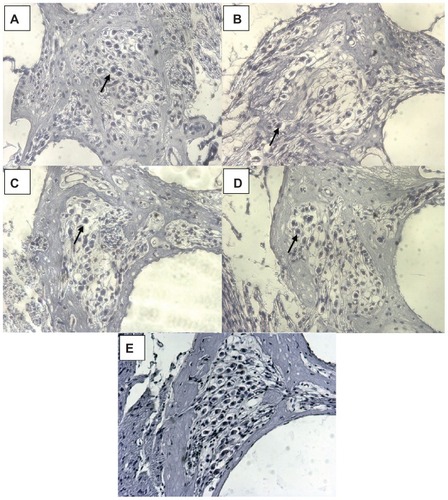 Figure 7 (A–D) Representative images of guinea pigs’ Rosenthal’s canals 21 days after deafening. (E) illustrates the SGC density in normal hearing animals as compared to the deafened ones in (A–D) (the picture is from a previous experiment registered at LAVES with the same registration number as the experiments described here: 07/1266). (A) is from an animal from the LNC–FITC group receiving the nanoparticle in a 1:100 dilution (stock solution 45 mg/ml LNC). (B) represents the Rosenthal’s canal of animals treated with LNC–FITC–rolipram (1:100 dilution of 45 mg/mL LNC and 19 μg/mL rolipram in stock solution) and (C) is from an animal that received rolipram (1:100 dilution of 19 μg/ml rolipram stock solution). An image of Rosenthal’s canal from the control group is shown in (D).Notes: In each picture, an arrows point to one representative vital SGC. Magnification: 200-fold.Abbreviation: SGC, spiral ganglion cells.