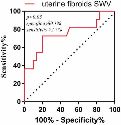Figure 6. Receiver operating characteristic (ROC) curve of preoperative fibroids’ SWV value to predict HIFU ablation rate < 70%.
