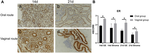 Figure 2 Photomicrographs (×200) showing immunohistochemical localization of ER in endometrium from oral and vaginal women. Both glandular epithelial and stromal compartments demonstrated more intense nuclear immunoreactivity for ER on day 14 (the proliferative phase) (a, c, (A)) than on day 21 (the secretory phase) (b, d, (A)) and more intense in the vaginal versus oral group (*P<0.05, (B)). GE= glandular epithelium. P values are for Mann–Whitney U-test. HSCORE:∑pi(i+1), where i = the intensity of staining, with a value of 1, 2, or 3 (weak, positive, or strong, respectively), and pi = the proportion of stained epithelial cells, varying from 0 to 100%.
