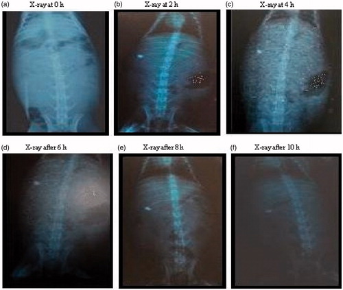 Figure 5. X-ray photographs at different time intervals of gastroretentive mucoadhesive tablets of lafutidine.