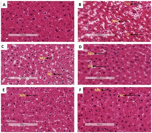 Figure 5 Effects of OA (n=6, per group) on liver oxidative stress of pre-diabetic rats on hepatocyte degeneration. Magnification of 20x100 µm, H&E staining, A-NPC, B-PC, C-MET, D-MET + DI, E-OA and F-OA + DI.