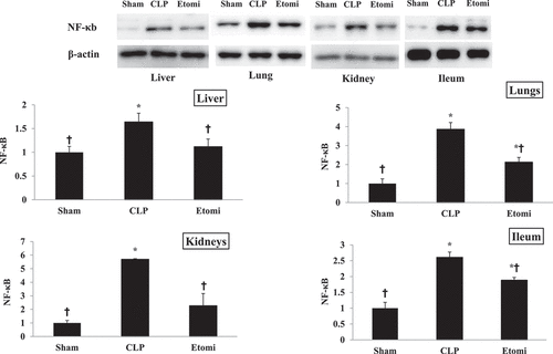 Figure 3. Effect of etomidate on activity of NF-κB in organs of CLP-induced septic rats. Liver, Lungs, kidneys and ileum were collected 24 h after surgery and NF-κB p65 activation was analyzed by Western blot. Etomidate treatment attenuated the increase in NF-κB activity after CLP surgery. *P<0.05 vs Sham, †P<0.05 vs CLP.