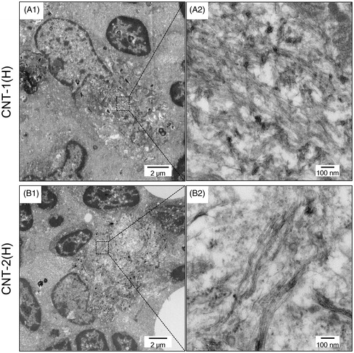 Figure 5. TEM images of mediastinal lymph nodes from rats exposed to CNT-1 or CNT-2 at a high dose at 90 d post-instillation. The mediastinal lymph nodes in the rats were fixed using 2.5% (v/v) glutaraldehyde for 2 h at 4 °C and 1% osmium oxide solution for 2 h at 4 °C, dehydrated in ethanol, and embedded in a commercially available epoxy resin. Samples were transferred to fresh resin in capsules and polymerized at 60 °C for 48 h. The TEM system was used to observe morphologic changes in the mediastinal lymph nodes of the rats.