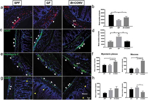 Figure 2. Bt normalizes expression of neuronal subtype post-GF perturbations.