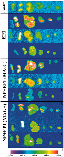 Figure 7. Tissue images of female BALB/c mice bearing C-26 colon carcinoma tumor after i.v. administration of a single dose of 12 mg/kg of free EPI and MMSN + EPI both in the presence and absence of external magnetic field. The organs from right to left are: spleen, kidney, liver, lung, heart and tumor. The control is dextrose-treated mouse. a, b and c: the mice sacrificed 40 min, 24 and 48 h post-injection of free EPI. d, e and f: the mice sacrificed 40 min, 24 and 48 h post-injection of MMSN + EPI in the absence of magnetic field. g, h and i: the mice sacrificed 40 min, 24 and 48 h post-injection of MMSN + EPI in presence of magnetic field. j: the below scale which indicates the fluorescence intensity. Red color indicates the highest fluorescent.