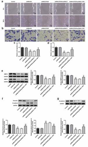 Figure 6. SP1 overexpression alleviated the effect of STK39 knockdown on Hep3b cells migration, invasion and EMT