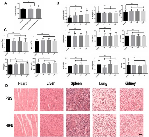 Figure 9 Biosafety assay. (A) Cell viability assay of different concentration CL-ICG-PFH-NPs incubated with HUVECs. (B) Blood biochemical indexes at different time points after biological targeting synergistic agent injections. (C) Blood routine indexes at different time points after biological targeting synergistic agent injections. (D) HE-stained images of major organs from healthy mice and mice treatment with HIFU ablation (200 × magnification), the scale bar is 20 µm.Abbreviations: HUVECS, human umbilical vein endothelial cells; WBC, white blood cell; RBC, red blood cell; HGB, hemoglobin; PLT, platelets; ALT, alanine aminotransferase; BUN, blood urea nitrogen; TP, total protein; ALB, albumin; AST, aspartate transaminase; AKLP, alkaline phosphatase; TBIL, total bilirubin; CREA, creatinine; LDH, lactate dehydrogenase; NS, no significance.