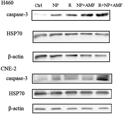Figure 7. Western blot of proteins extracted from NCI-H460 cells and CNE-2 cells 24 h after different treatments.