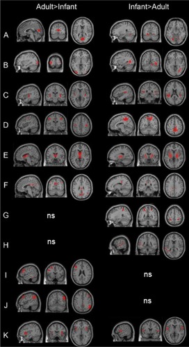 Figure 2 Regional differences in resting-state networks in infants and adults.