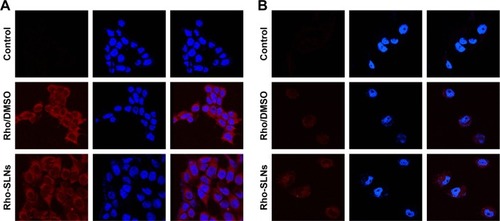 Figure 4 Confocal laser-scanning microscopy of internalization of Rho (red) in MCF7 (A) and MCF7/ADR (B) cells.Notes: Cells were treated with 0.4 µM Rho in DMSO (Rho/DMSO) or SLNs (Rho-SLNs) for 2 hours. Controls were untreated cells. Cell nuclei were stained with DAPI (blue).Abbreviations: Rho, rhodamine 123; DMSO, dimethyl sulfoxide; SLNs, solid lipid nanoparticles.