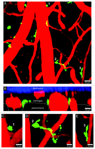 Figure 3. Visualization of CD11c-YFP+ APCs. A 3D time-lapse was captured through a thinned skull window of naïve CD11c-YFP mouse in a manner similar to that described in Figure 1. The majority of CD11c-YFP+ cells (green) visible through a thinned skull reside in the meninges and perivascular spaces. Panels A (xy projection) and B (xz projection) show that CD11c-YFP+ cells are sparsely distributed in the meninges and perivascular spaces of a naïve mouse. There are three distinct cellular morphologies depicted in panels C–E (labeled 1–3). Small spheroid cells (C) that resemble monocytes are visible around blood vessels. There are also long stringy cells 50–75 µm in length (D) that are not completely juxtaposed to the vasculature but are instead intertwined with vessels. Lastly, juxtavascular CD11c-YFP+ cells (E) are visible that share some similarities (e.g., amoeboid) to the perivasular macrophages seen in LysM-GFP mice. Skull bone is shown in blue. See Video S3.