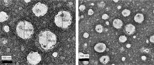 Figure 3 TEM images of KMO-enriched O/W nanoemulsion.Abbreviations: TEM, transmission electron microscopy; KMO, kojic monooleate; O/W, oil-in-water.