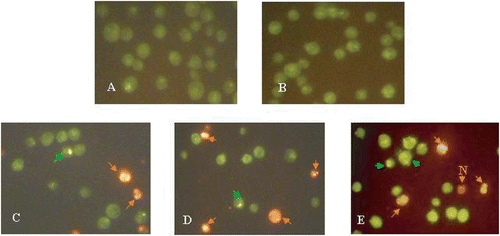 Figure 4. Morphological assessment of apoptosis and necrosis in K562 cells. Cells were heat treated at 45°C for different periods of time and studied 72 h after heat treatment. AO/EtBr double staining of K562 cells shows viable cells are uniformly green, early apoptotic cells are green with bright green dots in their nuclei (green arrows) and late apoptotic cells (orange arrows) are orange and in contrast to necrotic cells (orange arrows, N), they show condense fragmented nuclei. (A) Control K562 cells, (B-E) cells were heat treated at 45°C for 0, 20, 40 and 60 min, respectively. Cells were observed under fluorescence microscope at 400×.