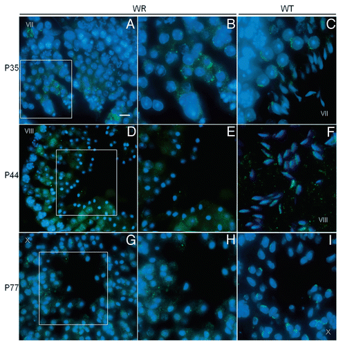 Figure 6 Localization of Vps54(L967Q) by immunofluorescence analysis in wr testis at different ages (P35, P44 and P77). Stages of the seminiferous epithelial cycle are marked with Roman numerals. Sections of wr (left and middle columns)) and wild-type littermate (right column) testes were labeled with antibodies to Vps54 (green); DAPI (blue) was used to stain nuclei. Compare the Vps54(L967Q) and Vps54 immunostainings. Vps54(L967Q) marks punctuated vesicles scattered within the spermatid cytoplasm, independently from the acrosomogenetic step. These vesicles do not develop into a polarized acrosomal cap (A and B, G and H) and acrosome (D and E) as, on the contrary, it occurs for the Vps54-labeled vesicles in the respective stages of the wild-type littermate spermatids/spermatozoa (C, I and F, respectively). Scale bars, 10 µm (A, D and G); 5 µm (B, C, F and I); 6 µm (E and H).