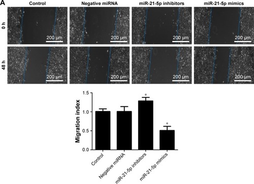 Figure 6 Analysis of the migration and invasion of SGC-7901 cells regulated by miR-21-5p assessed with wound healing and transwell assays.